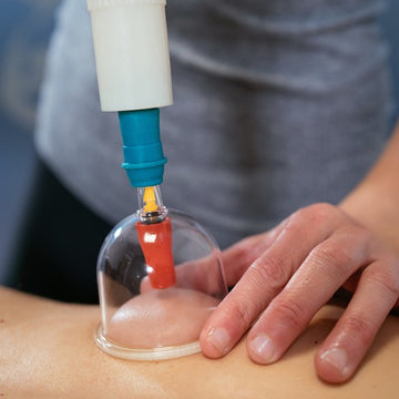 Cupping therapy